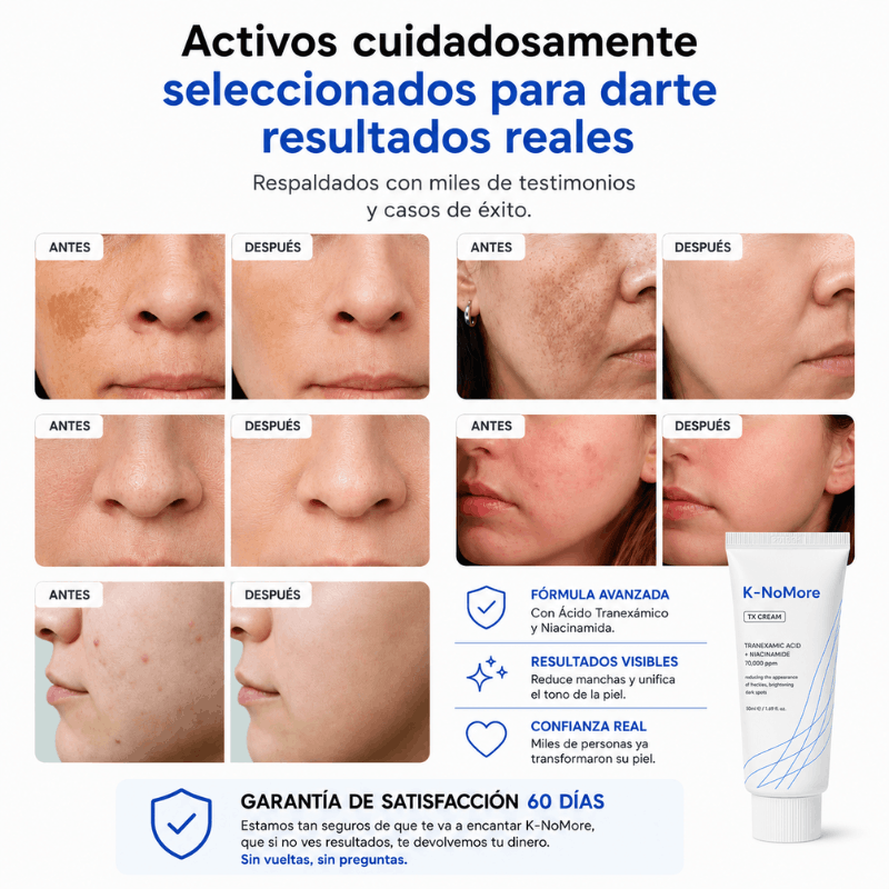 K-NoMore-Tratamiento Coreano para manchas y piel luminosa