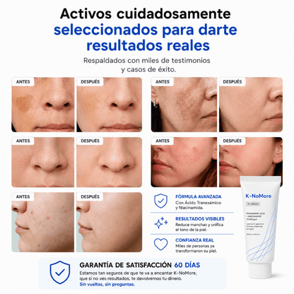 K-NoMore-Tratamiento Coreano para manchas y piel luminosa