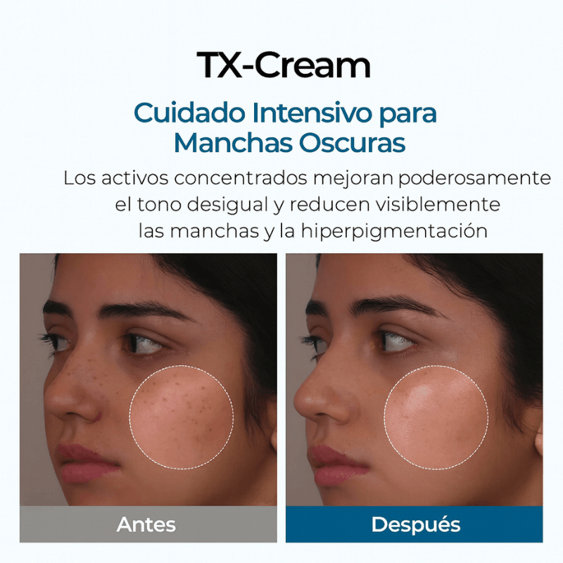 K-NoMore-Tratamiento Coreano para manchas y piel luminosa