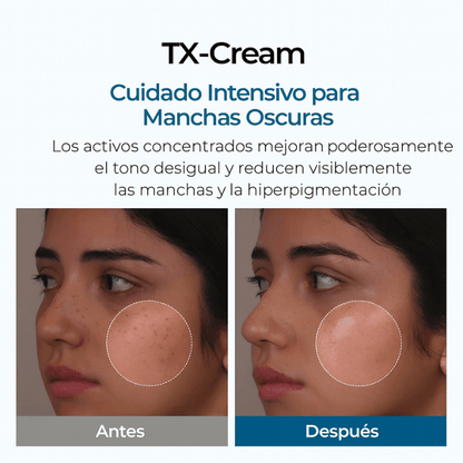 K-NoMore-Tratamiento Coreano para manchas y piel luminosa