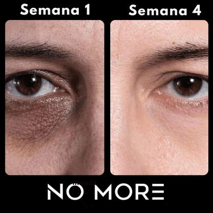 Roll-On anti ojeras – 10 segundos por día para eliminar ojeras