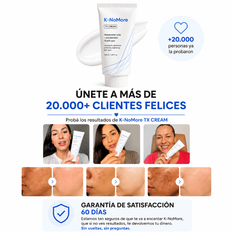 K-NoMore-Tratamiento Coreano para manchas y piel luminosa