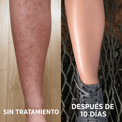 Crema Renovadora para Piel de Frutilla